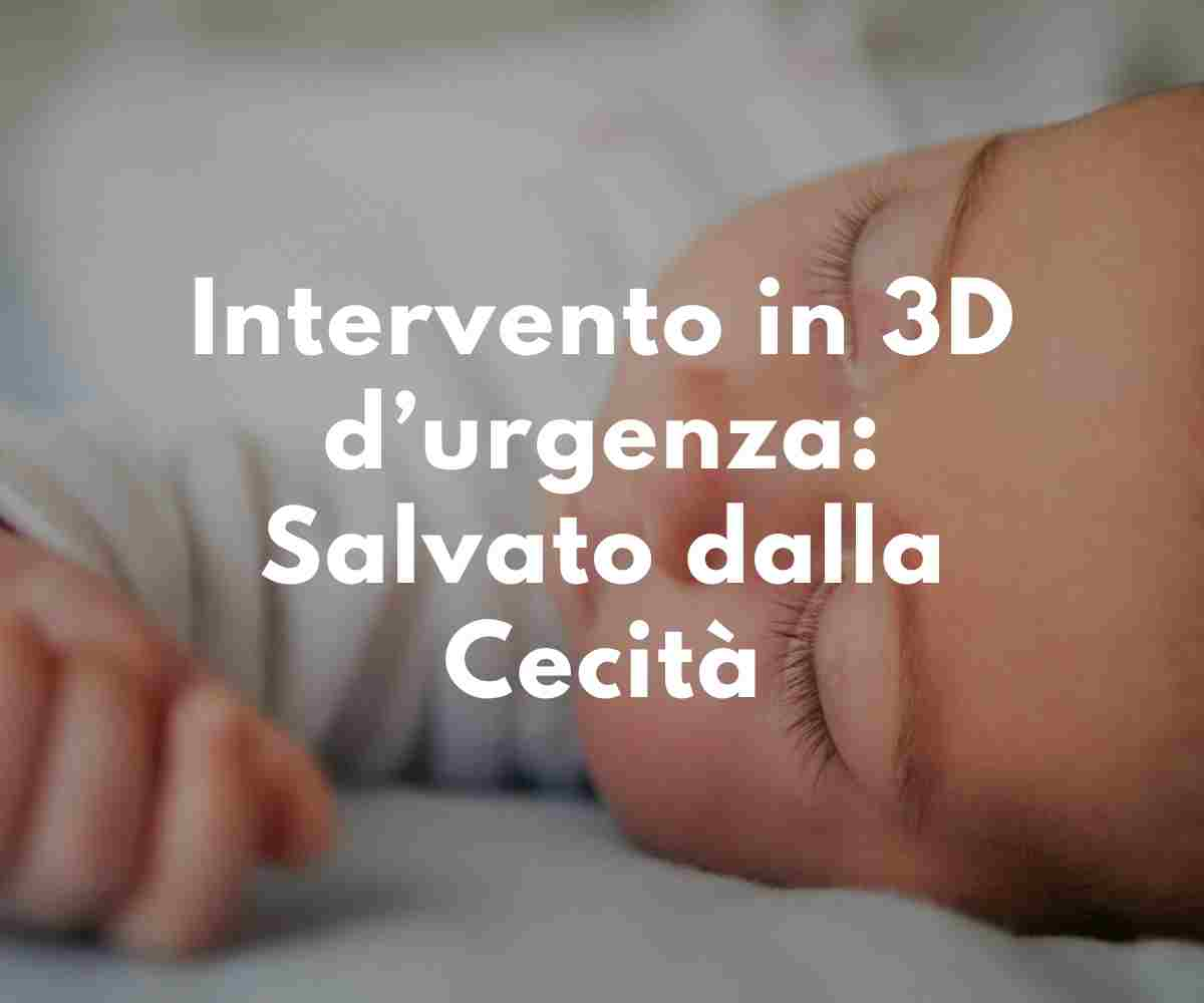 Intervento 3D 'Unico al Mondo'- Salva Neonato Dalla CecitàIntervento 3D 'Unico al Mondo'- Salva Neonato Dalla Cecità